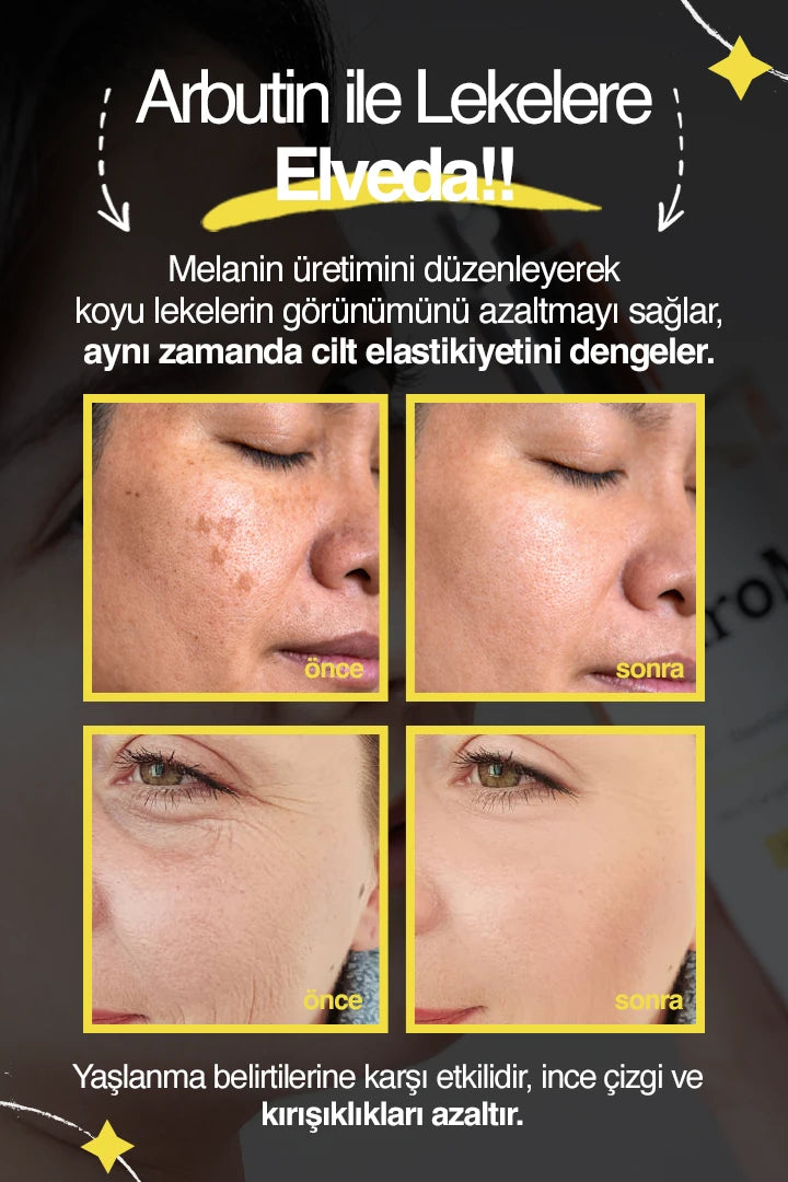 Leke & Yaşlanma Karşıtı Tonik